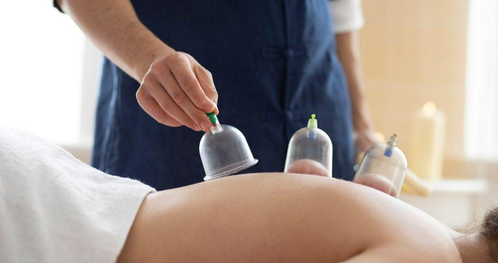 Cupping Therapy therapy at Carry Wellness